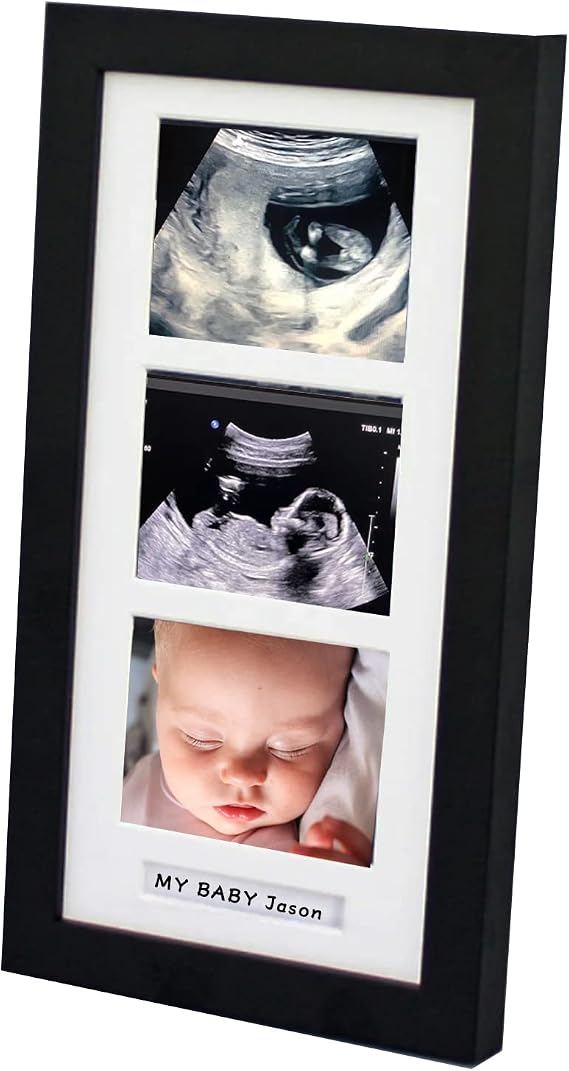 Pine Wood Triple Ultrasound Frame, 3 Sonogram Photos, Black